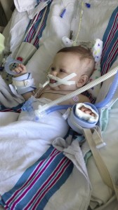 Week 2 of ICU In April. Just starting to get over his pneumonia